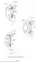 Fig. 02 - ACCOMMODATIVE INTRAOCULAR LENS SYSTEM