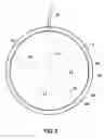 Fig. 03 - IMPLANTABLE PROSTHESIS WITH OPEN CELL FLOW REGULATION