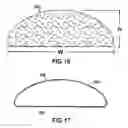 Fig. 10 - IMPLANTABLE PROSTHESIS WITH OPEN CELL FLOW REGULATION