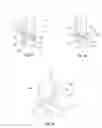 Fig. 18 - BONE PROSTHESIS