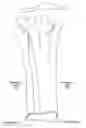 Fig. 01 - Amputation stabilization device