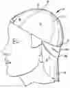 Fig. 01 - Baseball cap with neck protection visor