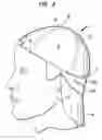 Fig. 03 - Baseball cap with neck protection visor
