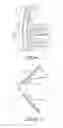 Fig. 09 - Anti-icing apparatus and method for aero-engine nose cone