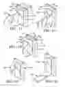 Fig. 09 - Apparatus and method for removably attaching window treatments