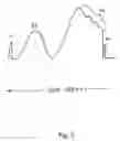 Fig. 04 - Tensiographic drophead
