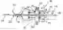 Fig. 01 - Buckle plate device