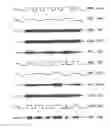 Fig. 09 - Precision timing pulse width communications transforming reshaped pulse stream