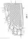 Fig. 07 - Microphone with reduced parasitic capacitance