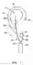 Fig. 02 - Wireless earring assembly