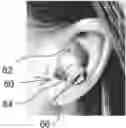 Fig. 01 - Occluding Earbud System and Method