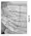 Fig. 28 - Blemish removal