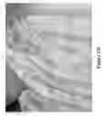 Fig. 30 - Blemish removal