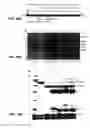 Fig. 20 - Antibodies against anthrax protective antigen
