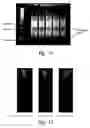 Fig. 11 - Inhibition of metallo-β-lactamase