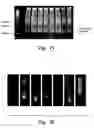 Fig. 12 - Inhibition of metallo-β-lactamase