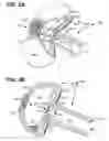 Fig. 04 - Pneumostoma management device and method for treatment of chronic obstructive pulmonary disease