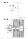 Fig. 05 - Pneumostoma management device and method for treatment of chronic obstructive pulmonary disease