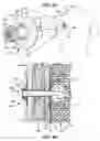 Fig. 22 - ACCELERATED TWO-PHASE SURGICAL PROCEDURE FOR CREATING A PNEUMOSTOMA TO TREAT CHRONIC OBSTRUCTIVE PULMONARY DISEASE