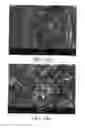 Fig. 02 - Method for modifying surface of titanium or titanium alloy by fluidized bed carburization