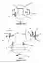 Fig. 02 - AUTOCLAVABLE BUCKETLESS CLEANING SYSTEM
