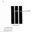 Fig. 02 - ASSAY METHOD FOR HUMAN OROTATE PHOSPHORIBOSYLTRANSFERASE PROTEIN