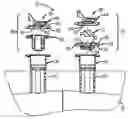 Fig. 01 - Port closure system for intravenous fluid container