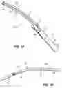 Fig. 02 - Devices, Tools and Methods for Atrial Appendage Exclusion