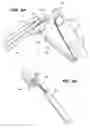Fig. 05 - Devices, Tools and Methods for Atrial Appendage Exclusion