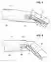 Fig. 06 - Devices, Tools and Methods for Atrial Appendage Exclusion