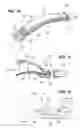 Fig. 10 - Devices, Tools and Methods for Atrial Appendage Exclusion