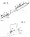 Fig. 11 - Devices, Tools and Methods for Atrial Appendage Exclusion