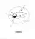 Fig. 05 - Apparatus and method for preventing glaucomatous optic neuropathy