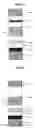 Fig. 04 - Method for the detection of lateral flow assay and strip and laser-induced epifluorescence and compact scanner therefor