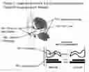 Fig. 04 - Earpiece sealing system
