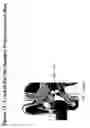 Fig. 16 - Earpiece sealing system