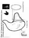 Fig. 20 - Earpiece sealing system