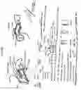 Fig. 31 - Earpiece sealing system