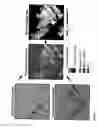 Fig. 08 - Remote sensing analysis of forest disturbances