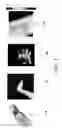 Fig. 02 - Method of assessing a body part