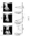 Fig. 04 - Method of assessing a body part