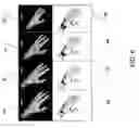 Fig. 07 - Method of assessing a body part