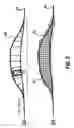 Fig. 09 - Method of assessing a body part