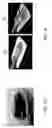 Fig. 10 - Method of assessing a body part