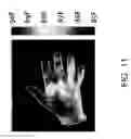 Fig. 11 - Method of assessing a body part
