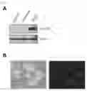 Fig. 04 - Recombinant vector expressing MDR1 shRNA and thymidine kinase and use thereof