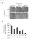 Fig. 07 - Recombinant vector expressing MDR1 shRNA and thymidine kinase and use thereof