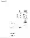 Fig. 07 - Soluble CLCA-1 and antagonists to CLCA-1