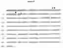 Fig. 06 - TRUNCATED MEMAPSIN 2 COMPOSITIONS AND TREATMENTS