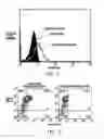 Fig. 02 - Imaging and Therapeutic Method Using Monocytes